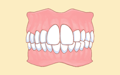 大きい歯の治療前
