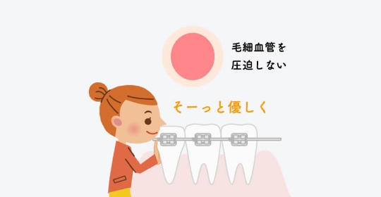 歯を抜かない矯正