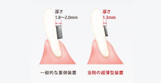 痛み・違和感が少ない